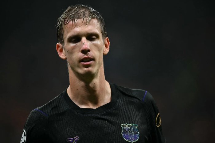 Dani Olmo sofre lesão contra o PSG e desfalca o Barcelona no El Clásico